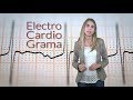 2 minutos por tu corazón: ¿Qué es un electrocardiograma y para qué sirve?