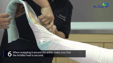 [APPLICATION VIDEO] LONG LEG SPLINT
