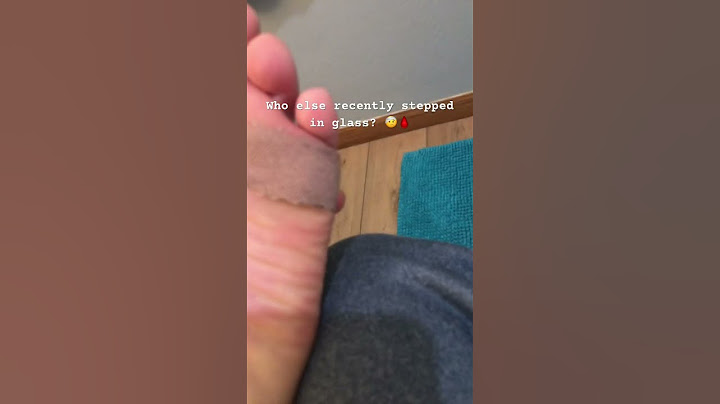 I got glass in my foot!!! #subscribe #feet #hurt