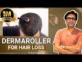 Dermaroller for Hair Loss: How to Use Derma Roller for Hair Growth? | Dermaroller का उपयोग कैसे करें