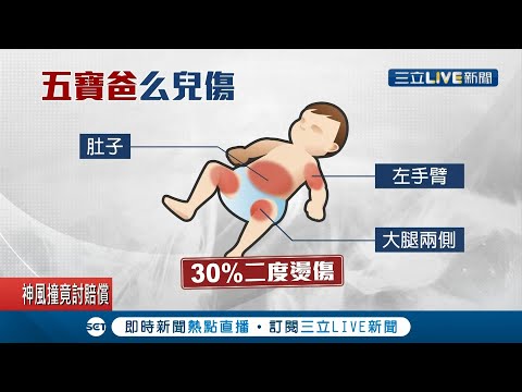 台中"五寶爸"風波不斷！妻子幫七個月大男嬰洗澡遭熱水燙傷 全身近30%二度燙傷！社會局介入調查認定是"意外"！│記者王子瑜 陳逸潔│【LIVE大現場】2