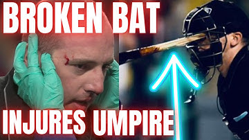 Home plate umpire hit in face by Mike Trout