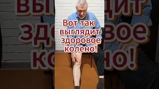 🔥Вот так выглядит здоровое колено! Проверь подвижность коленной чашечки!