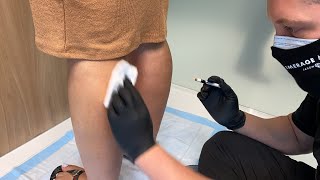 PROCEDURE FOR SLIMMING MY CALVES | BOTOX TO THE CALVES | Dr. Jason Emer