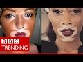 Winnie Harlow - The model who's bringing vitiligo into the open - BBC Trending