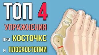 Топ-4 УПРАЖНЕНИЯ от КОСТОЧКИ на большом пальце ноги (Hallux Valgus) или ПЛОСКОСТОПИЯ