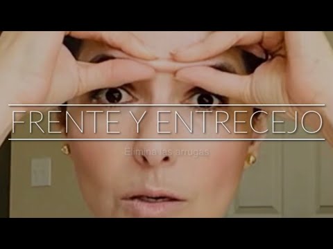 Elimina las arrugas de la Frente y Entrecejo para evitar el Botox