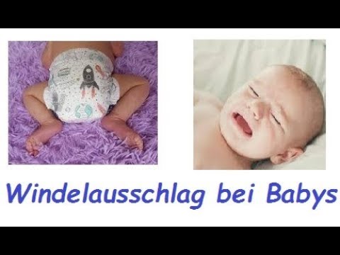 Video: Wie Man Windelausschlag Bei Einem Baby Loswird