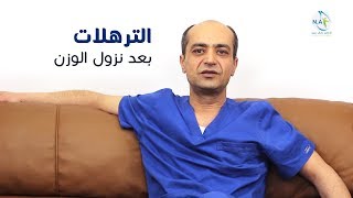 الترهلات بعد نزول الوزن | د. نضال عمرو