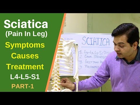 Sciatica, Sciatic Nerve Pain(L4-L5-S1) Treatment of Sciatica (LEG PAIN)Sciatica Pain relief PART-1