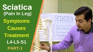 Sciatica, Sciatic Nerve Pain(L4L5S1) Treatment of Sciatica (LEG PAIN)Sciatica Pain relief PART1