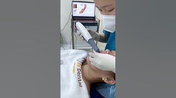 🤩 ĐỪNG LÀM RĂNG SỨ NẾU CHƯA THỬ CÔNG NGHỆ LẤY DẤU SCAN 3D! 🚀tại NHA KHOA SV