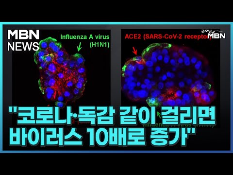   코로나 독감 같이 걸리면 바이러스 10배로 증가 중증 사망위험 더 높다 굿모닝 MBN