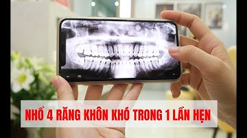 TRỰC TIẾP NHỔ RĂNG KHÔN KHÓ CHỈ CHỈ CẦN GÂY TÊ (NHỔ 4 RĂNG TRONG 1 LẦN HẸN)