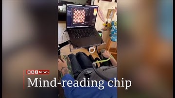 The man with a mind-reading chip in his brain - (USA) 23/Mar/2025