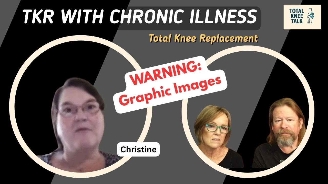 Knee Replacement Recovery with Chronic Illness & Adhesive Allergies: An Honest Journey