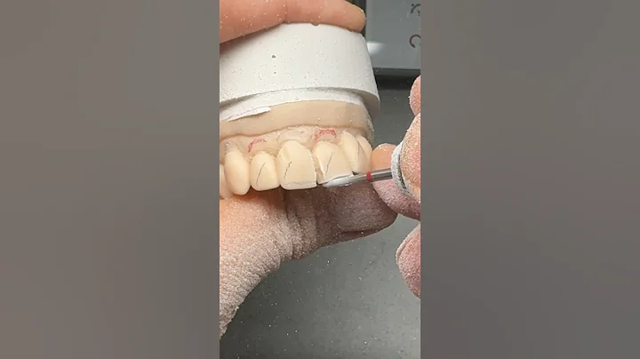 Wax-Up Prep @EnvisiontecMain  #envisiontec #dental #lsk121shorts #teeth #smile #shortvideo