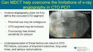 CVI 2019_Thursday 7/18_ PCI how to part 2: CTOs_Farouc Jaffer, MD, PhD