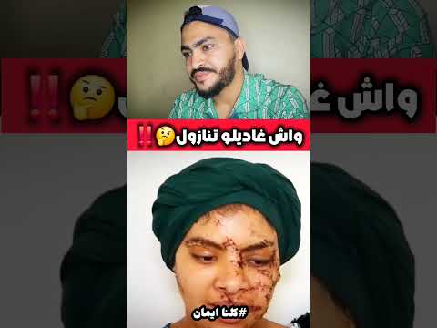 ضربها فالوجه ديالها 130غرزة وطلبنها ديرليه تتازول كلنا ايمان
