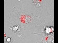 Dendroid cell attacks fungal invader