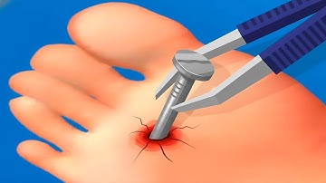 Foot Clinic - Gameplay Walkthrough - All Levels (IOS, Android)