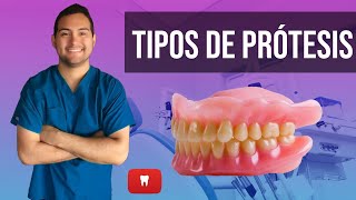 PRÓTESIS DENTAL: TIPOS / GUÍA PRACTICA 👄 (2018) #25