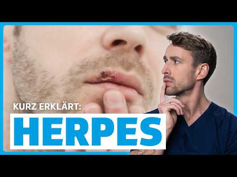 Herpes verstehen: Ursachen, Symptome, Diagnose & Therapie | DocTommy