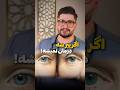 چگونه از چروک و پیری پوست دور چشم جلوگیری کنیم و درمانش چیه زیبایی پوست دکترخیرالهی