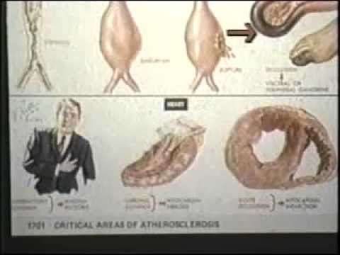 the-dangers-of-milk,-meat-and-eggs-and-the-connected-illnesses-!-(part-2-of-6)