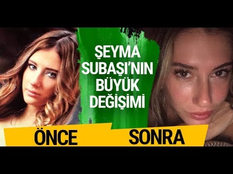 şeyma subaşı estetik görüntüleri eski halini görünce şok olacaksınız -  şeyma subaşı bikini