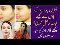 How to remove facial hair  jism ke ghair zaruri baal  laser hair removal  dr ayesha tips