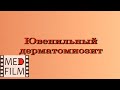 Ювенильный дерматомиозит © juvenile dermatomyositis