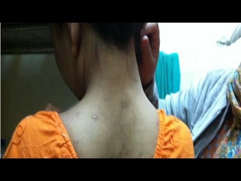 العفو الدولية تنتقد إساءة معاملة بعض الخادمات في قطر