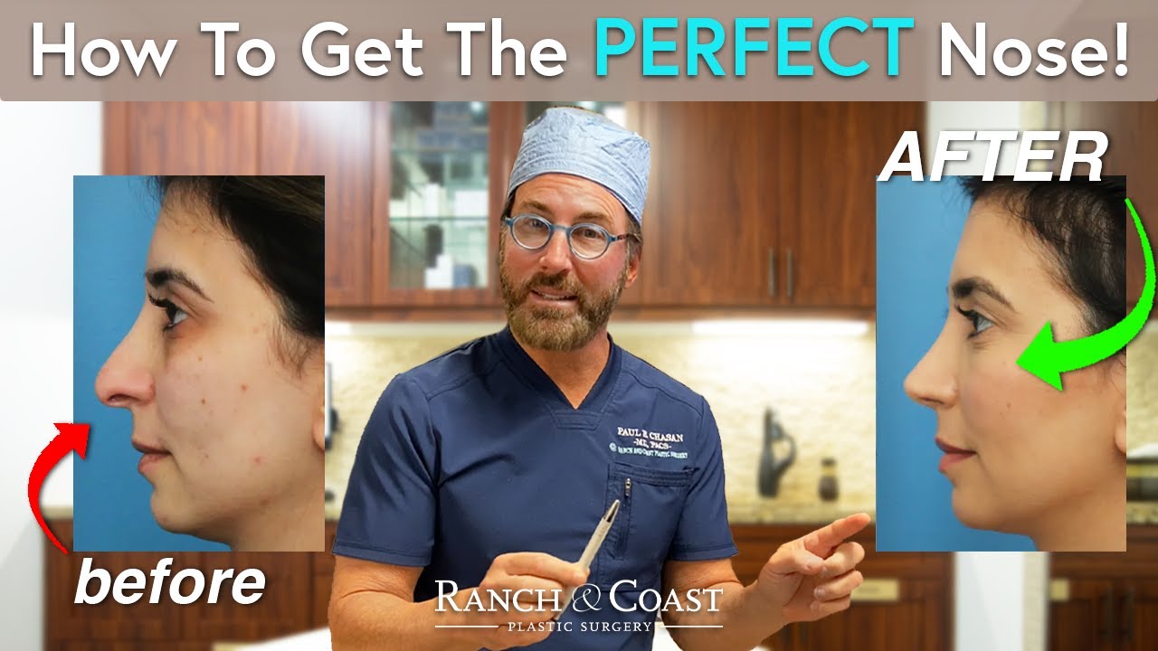 How to Get the PERFECT Nose Job! YouTube