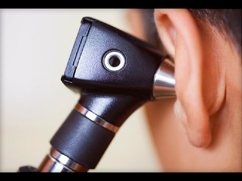 וִידֵאוֹ: דלקת אוזניים כרונית (דלקות אוזניים) וההליך הניתוחי שאנו מכנים TECA