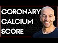 Coronary calcium score: what it means and how to interpret your results (AMA #5)