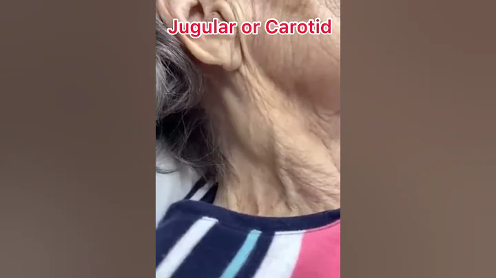 Jugular or Carotid ??? neck vessels