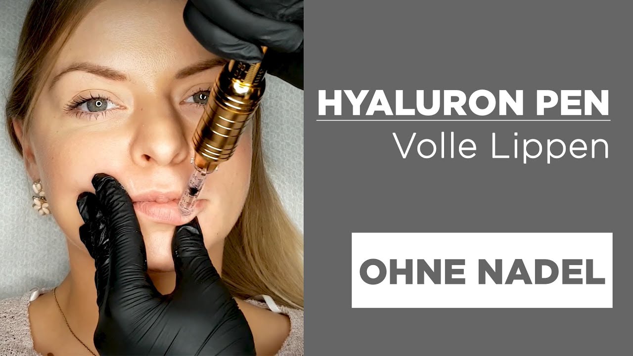Hyaluron Pen LIPPEN VOLUMEN schmerzfrei und ohne Nadel! - YouTube