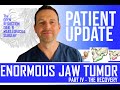 PATIENT UPDATE: ENORMOUS JAW TUMOR, the RECOVERY