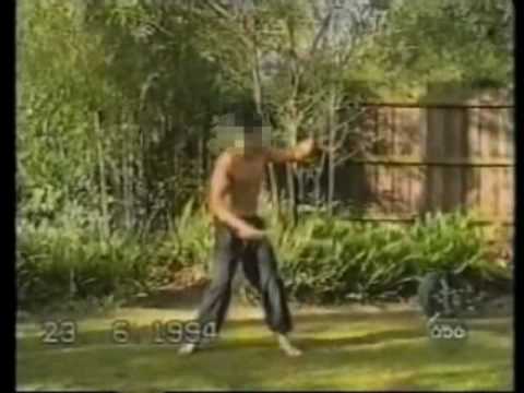 Nunchaku accident