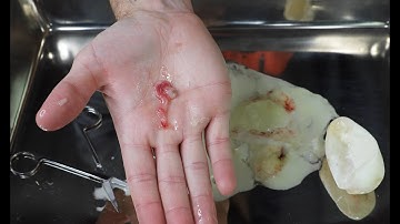 BALL PYTHON EMBRYO FROM INFERTILE EGG!