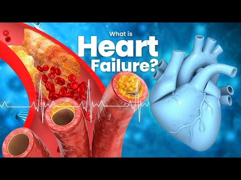 Heart Failure - Symptoms, Causes, and Treatment | 3D Guide
