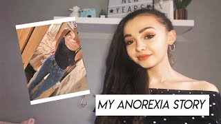 My Anorexia Story