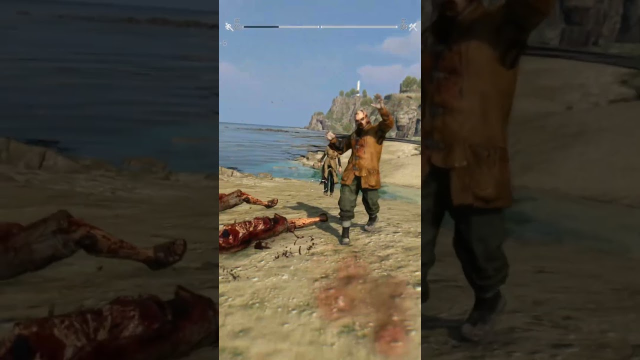 💀DL the Following Retouched 