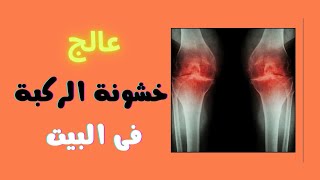 علاج خشونة الركبة | أفضل تمارين لعلاج خشونة الركبة فى المنزل