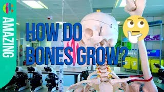 How do Bones Grow?? ☠ | Operation Ouch!