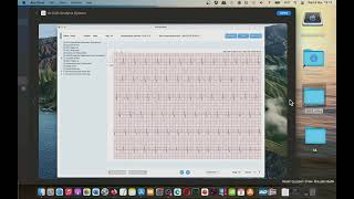 AI ECG Analysis System ECG Browser Mac App Store Basic Overview screenshot 3
