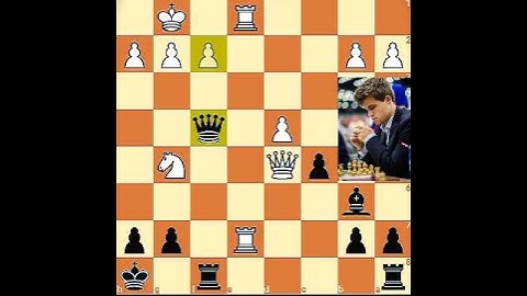 Brain function: Chess can improve your memory, attention span, and overall brain function.