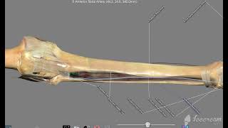 Major arteries from the heart to the toes on the Anatomage table.