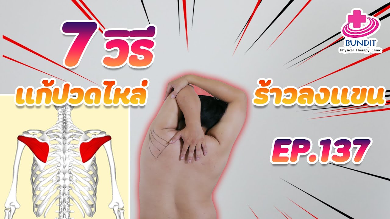 7 วิธีแก้ปวดไหล่ร้าวลงแขน | กายภาพง่ายๆกับบัณฑิต Ep.137